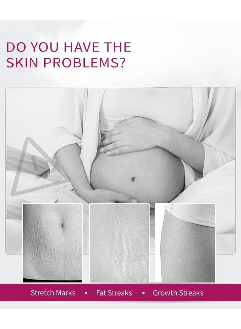 RtopR Mango Pregnancy Scars Cream Maternity Repair Enhance Skin Elasticity Stretch Marks Treatment for Wrinkles Obesity Stretch Mark Moisturizing Remove Marks 40g - Image 2
