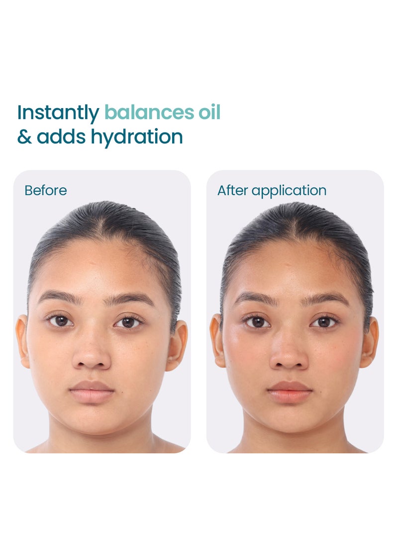 WishCare 2:1:3 NMF Water Gel Moisturizer for Face Oily Skin, Dry Skin, 50ml | Oil-Free Moisturizer Cream For Acne Prone Face, With Niacinamide, Zinc PCA & NMF, Controls Oil & Hydrates, For Women & Men - Image 3