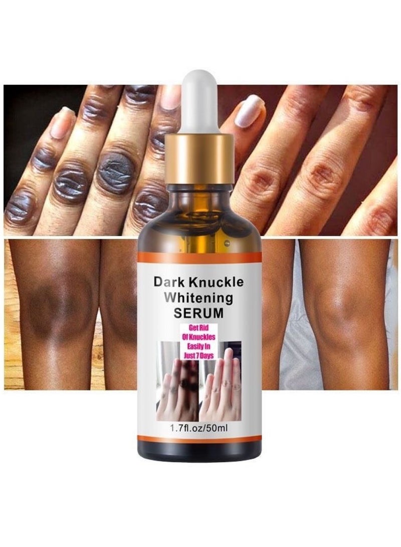 MOOYAM Dark Knuckle Whitening Serum - Skin Whitening Oil Brightening Dark Spots,Elbow Armpit Whitening Knee Melanin，Dark Knees and Elbows Strong Whitening Cream for Correcting Dark Spots, Armpits, Neck, Knee, Elbow, Inner Thigh-50ML  - Image 3