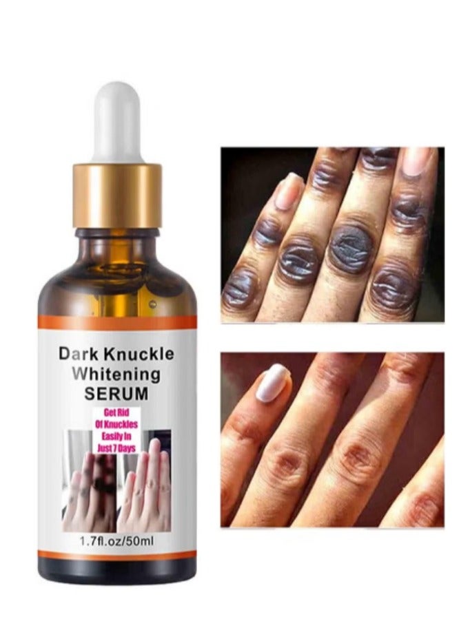 MOOYAM Dark Knuckle Whitening Serum - Skin Whitening Oil Brightening Dark Spots,Elbow Armpit Whitening Knee Melanin，Dark Knees and Elbows Strong Whitening Cream for Correcting Dark Spots, Armpits, Neck, Knee, Elbow, Inner Thigh-50ML  - Image 2