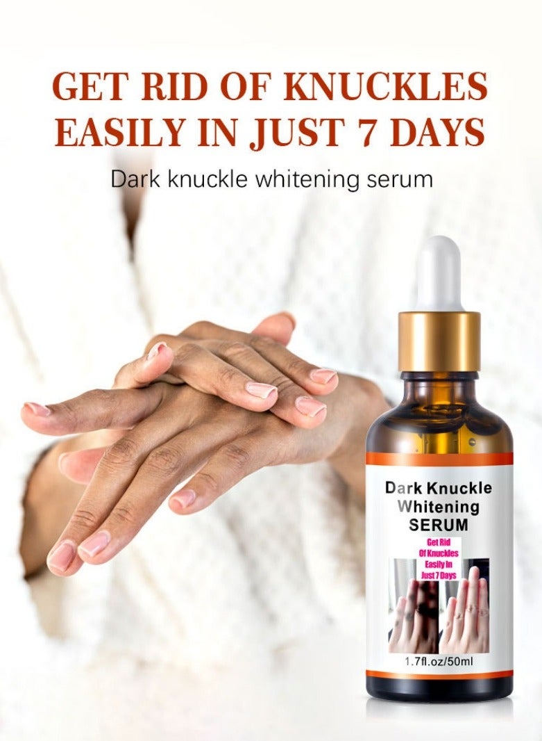 MOOYAM Dark Knuckle Whitening Serum - Skin Whitening Oil Brightening Dark Spots,Elbow Armpit Whitening Knee Melanin，Dark Knees and Elbows Strong Whitening Cream for Correcting Dark Spots, Armpits, Neck, Knee, Elbow, Inner Thigh-50ML  - Image 5