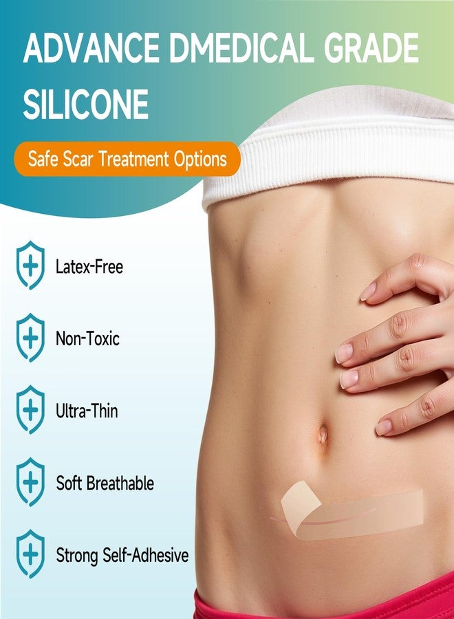 Gaayou Silicone Scar Sheets, Silicone Scar Tape (1.6"x120 " Roll-3M) Reusable Professional Scar Silicone Strips Soft Silicone Scar Patches for Scar Removal Treatment, Surgical Scars, Keloid, C-Section, Burn - Image 2