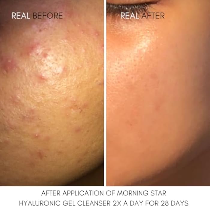 NUT BOTANICALS Morning Star Hyaluronic Gel Cleanser - Image 2