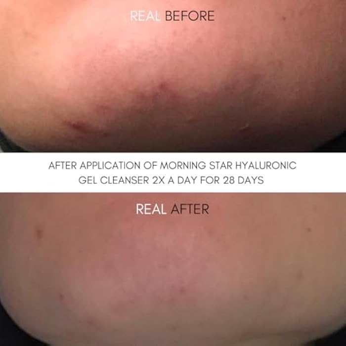 NUT BOTANICALS Morning Star Hyaluronic Gel Cleanser - Image 4