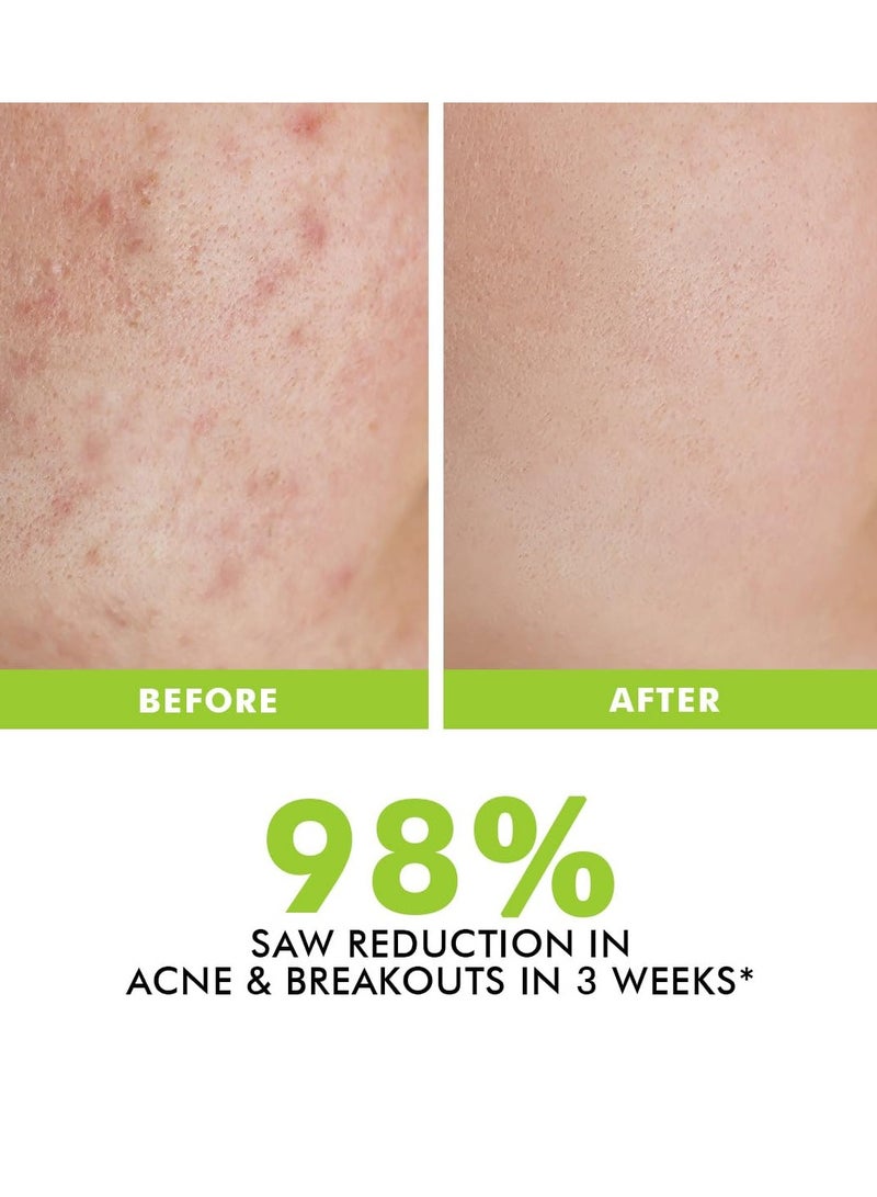 CONSCIOUS CHEMIST 2% Salicylic Acid Cream | 50g | Acne Spot Corrector | Moisturizer for Oily Acne Prone Skin, Face Cream for Men & Women, Overnight Acne & Oil Control, Itchiness & Redness, Non greasy Gel Cream - Flashfix - Image 5