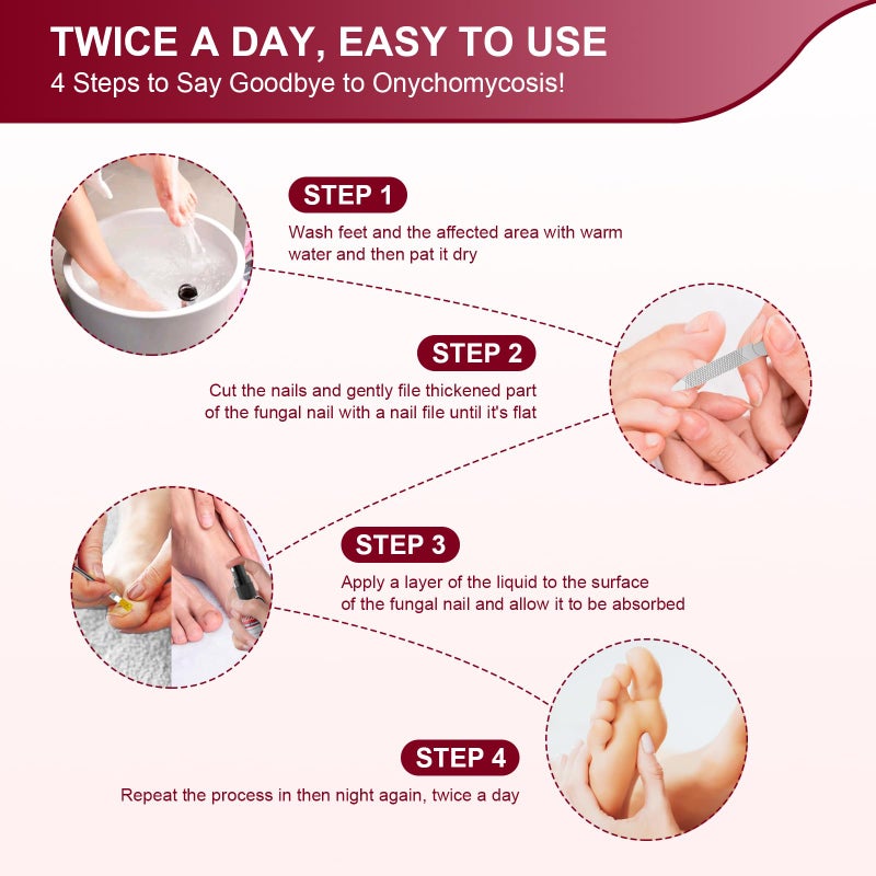 sidinox Toenail Fungus Treatment, Treatment Extra Strength with 25% Undecylenic Acid, Fungus Nail Treatment for Damaged Nails, Discolored, Thick Toenails, Help Nail Grow - (1 Fl Oz/30 ml x 5 Pack) - Image 3