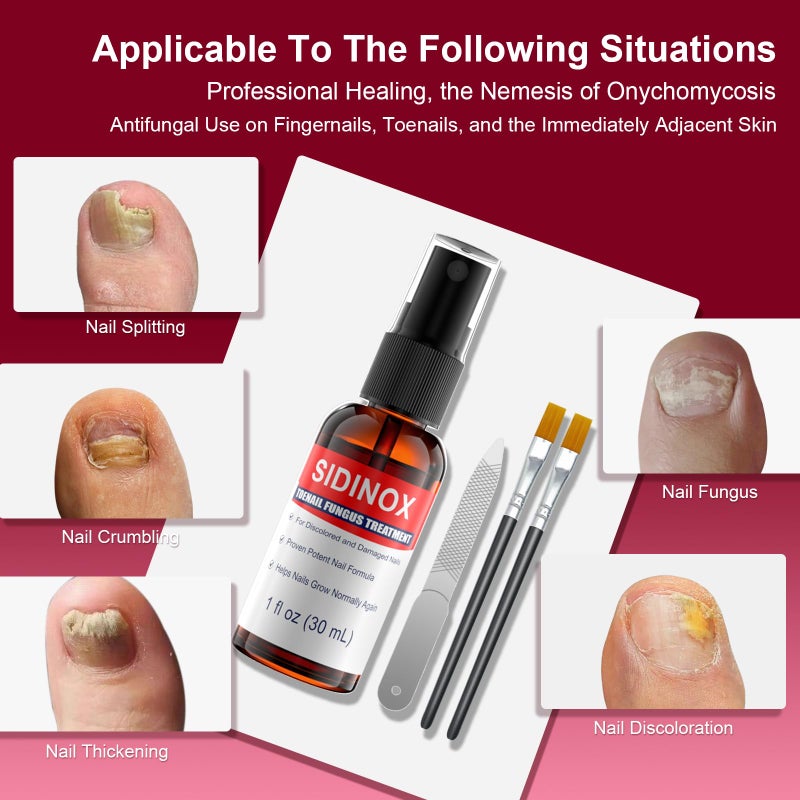 sidinox Toenail Fungus Treatment, Treatment Extra Strength with 25% Undecylenic Acid, Fungus Nail Treatment for Damaged Nails, Discolored, Thick Toenails, Help Nail Grow - (1 Fl Oz/30 ml x 5 Pack) - Image 2