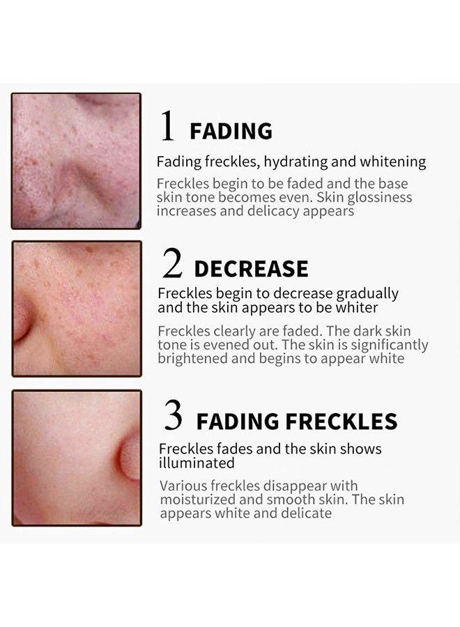 سنملبم كريم النمش عالي الكفاءة ومزيل النمش ومشرق كريم الكلف المصحح للبقع الداكنة المرطب العميق للرجال والنساء 30 غرام - Image 4