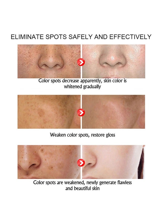 SNMLPM Freckle Cream,High Efficiency Freckle Cream Freckle Remover Brightening Deep Moisturizing Dark Spot Corrector Melasma Cream For Men & Women 30g - Image 5