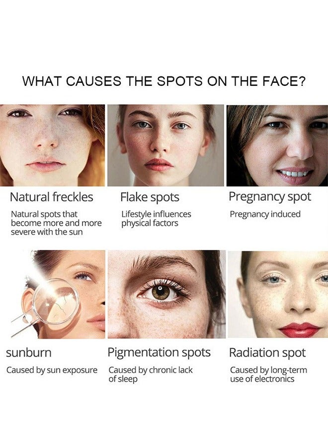 SNMLPM Freckle Cream,High Efficiency Freckle Cream Freckle Remover Brightening Deep Moisturizing Dark Spot Corrector Melasma Cream For Men & Women 30g - Image 3