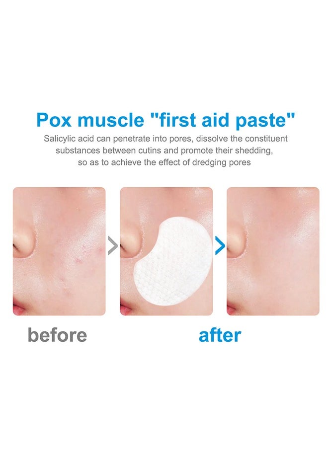 Salicylic Acid Oil Control Cotton Mask, Acne Treatment Pads, Anti-aging,Exfoliating Chemical Peel Pad, Acne Control Pads for Pimple Breakout, Clear Skin, 50 Pads - pzsku/ZFDA7F7C3E1C9F21AB742Z/45/_/1717301062/e8f6bc02-a7d8-4e76-b7e3-19dc28553bf5