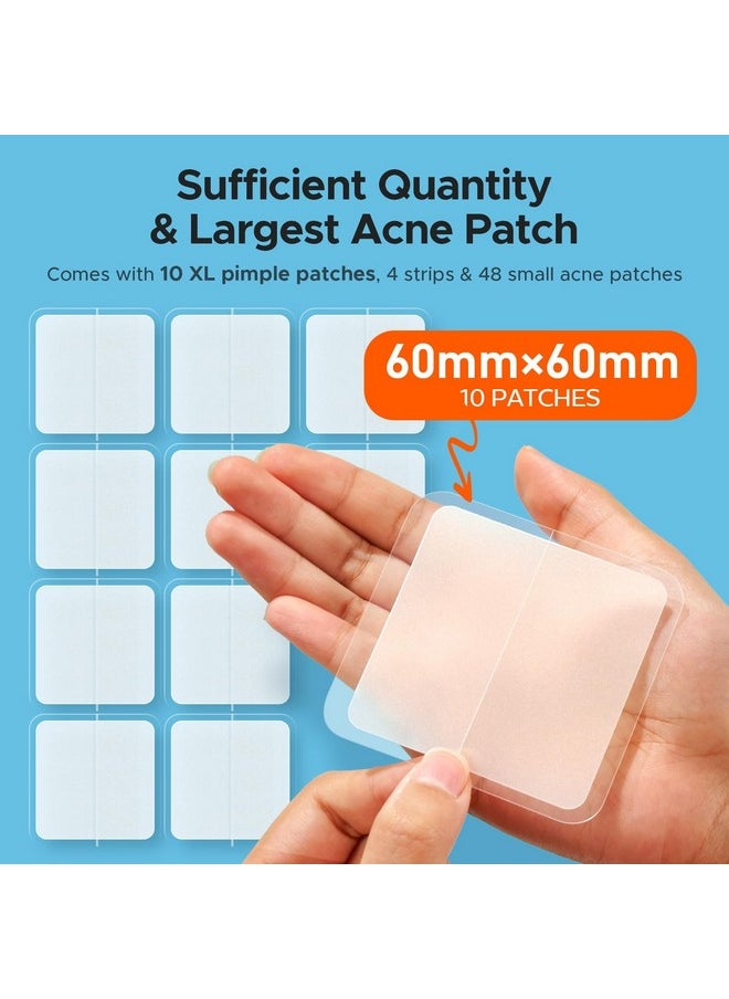 TKTK - TKTK Large Pimple Patches, 60 mm XL Acne Patches, Big Hydrocolloid Bandages for Body, Face, Forehead, Chin, Neck Zit Breakouts, Hydrocolloid Patch (Square, Strip, Dot 5 Sizes 62 Count) - Image 1
