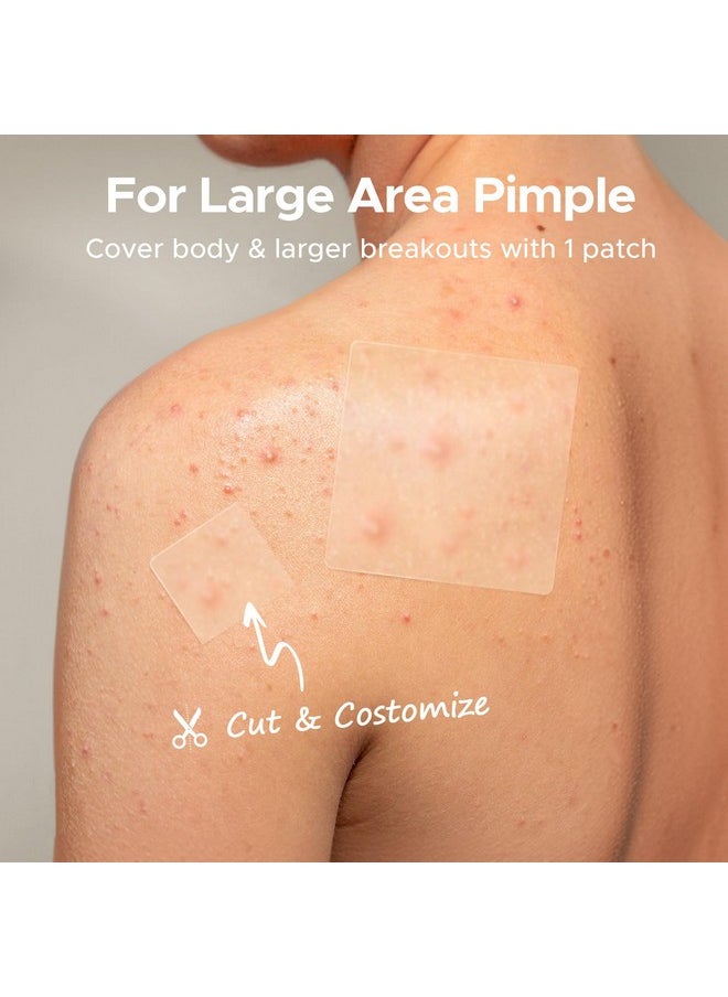 TKTK - TKTK Large Pimple Patches, 60 mm XL Acne Patches, Big Hydrocolloid Bandages for Body, Face, Forehead, Chin, Neck Zit Breakouts, Hydrocolloid Patch (Square, Strip, Dot 5 Sizes 62 Count) - Image 1