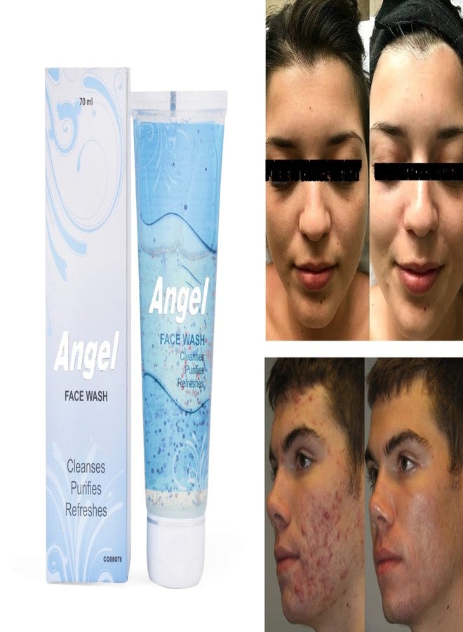 Angel Facewash for Daily Use - Image 4