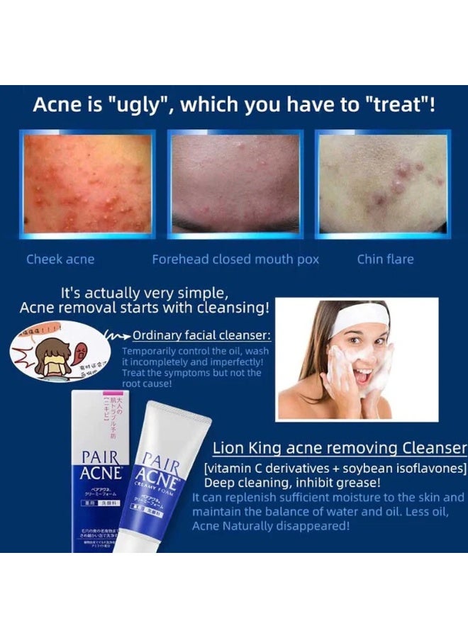 Pair Acne Creamy foam 80g Made in Japan - Image 4