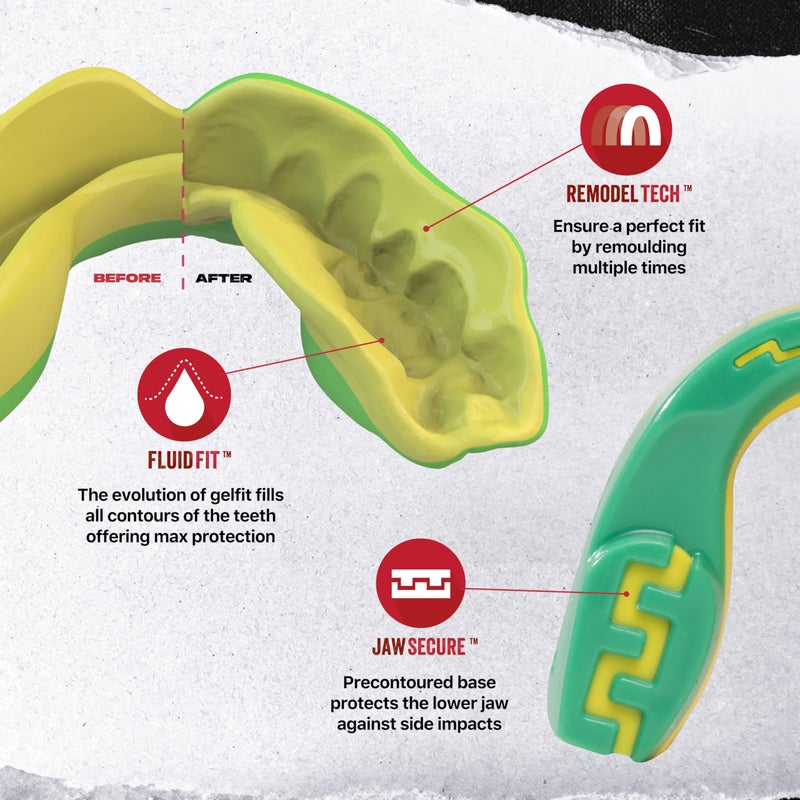Safejawz Sports Mouthguard  Dual Layer Premium Mouth Guard With Case For Basketball  Lacrosse  Football  Martial Arts  Hockey  Wrestling  Ice Hockey And All Contact Sports - Image 3