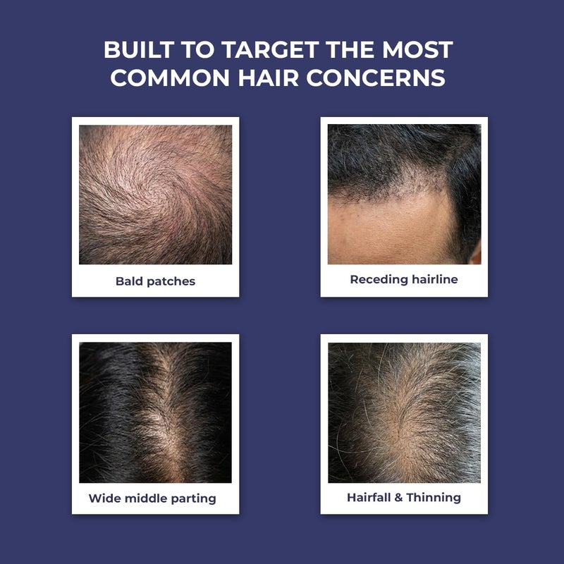 كيميائي واعي بخاخ Conscious Chemist Full Strength بالروزماري لمكافحة تساقط الشعر (يُستخدم بعد الغسل) - 200 مل - Image 5