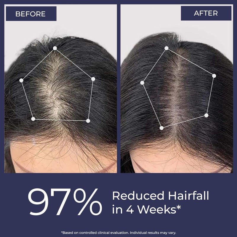 كيميائي واعي بخاخ Conscious Chemist Full Strength بالروزماري لمكافحة تساقط الشعر (يُستخدم بعد الغسل) - 200 مل - Image 3