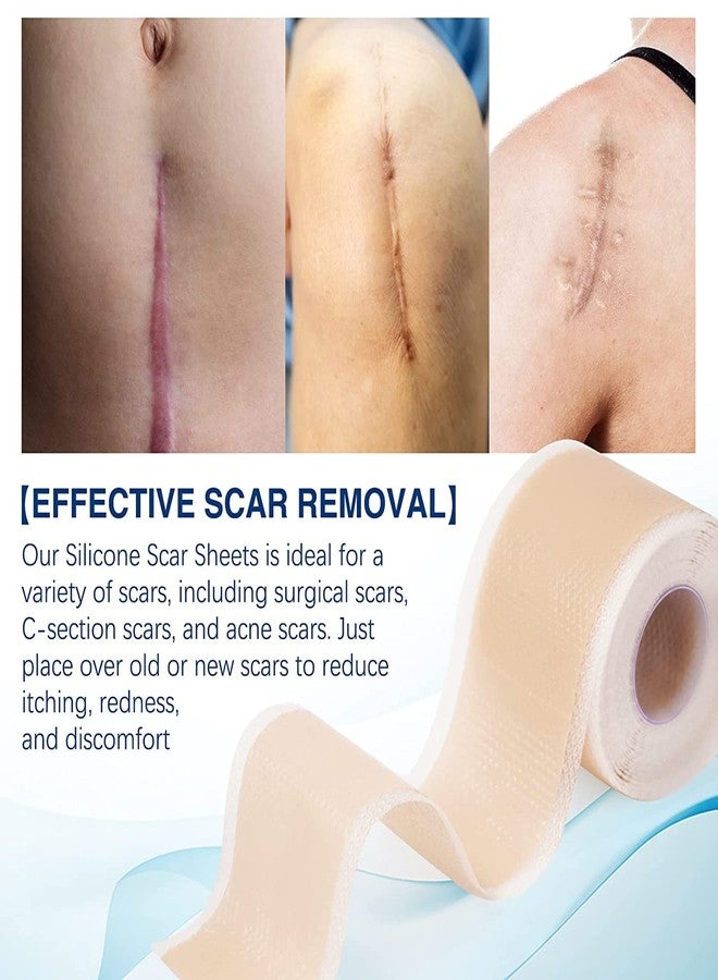 DROPOSALE Silicone Scar Tape for Surgical Scars - 60" x 1.5" Roll - Extra Long Scar Sheets for C-Section, Tummy Tuck, Keloid, and Surgical Scars - Reusable Medical Grade Silicone Scar Tape. (Pack of 1) - Image 5