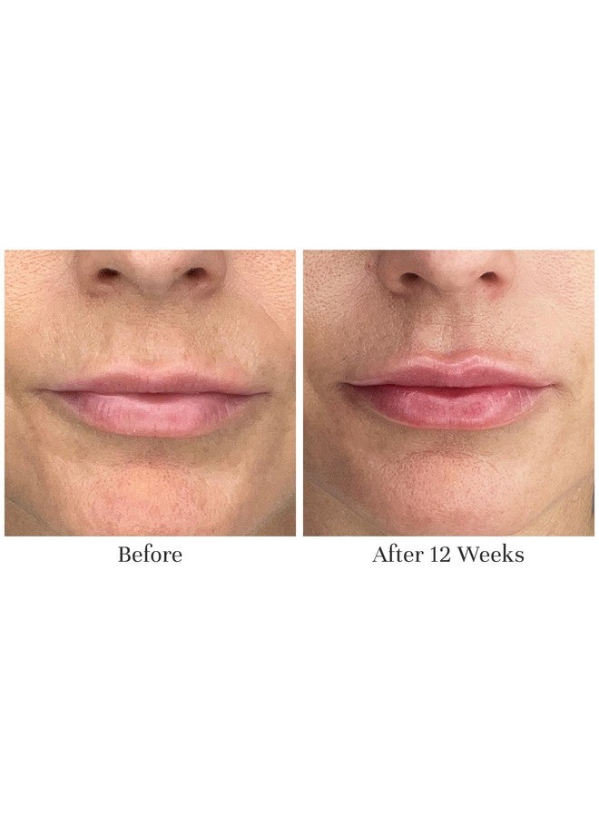 City Beauty City Lips Night Oilplumping Lip Oilhydrate & Volumizesolution For Chapped Cracked Dry Lipscrueltyfree - Image 2