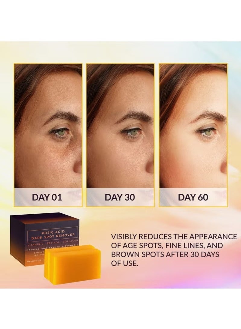 KOJIC ACID صابون حمض الكوجيك، صابون إزالة البقع الداكنة بحمض الكوجيك، صابون الكركم الطبيعي، مناسب للوجه والجسم (طقم مكون من 2 قطعة) - Image 5
