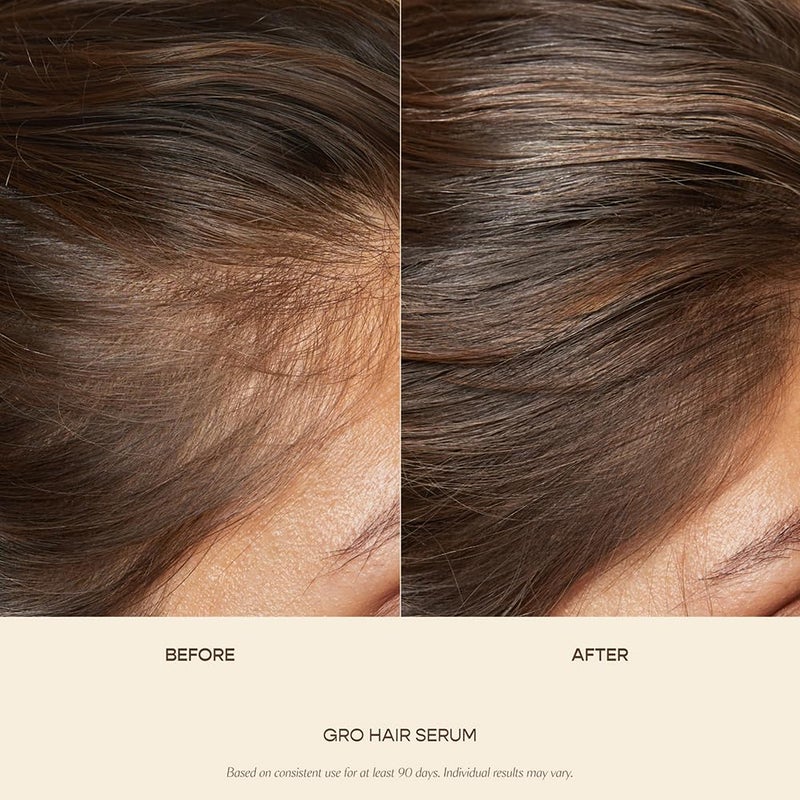 VEGAMOUR GRO Hair Serum for Hair Thinning, Thicker Fuller Looking Hair, Non Oily Serum for Healthier Scalp, 30 day Supply 1.0 fl oz, 1 pack - Image 2