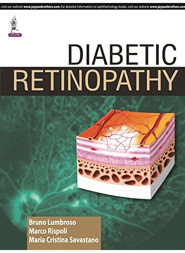 null - Diabetic Retinopathy - Image 1