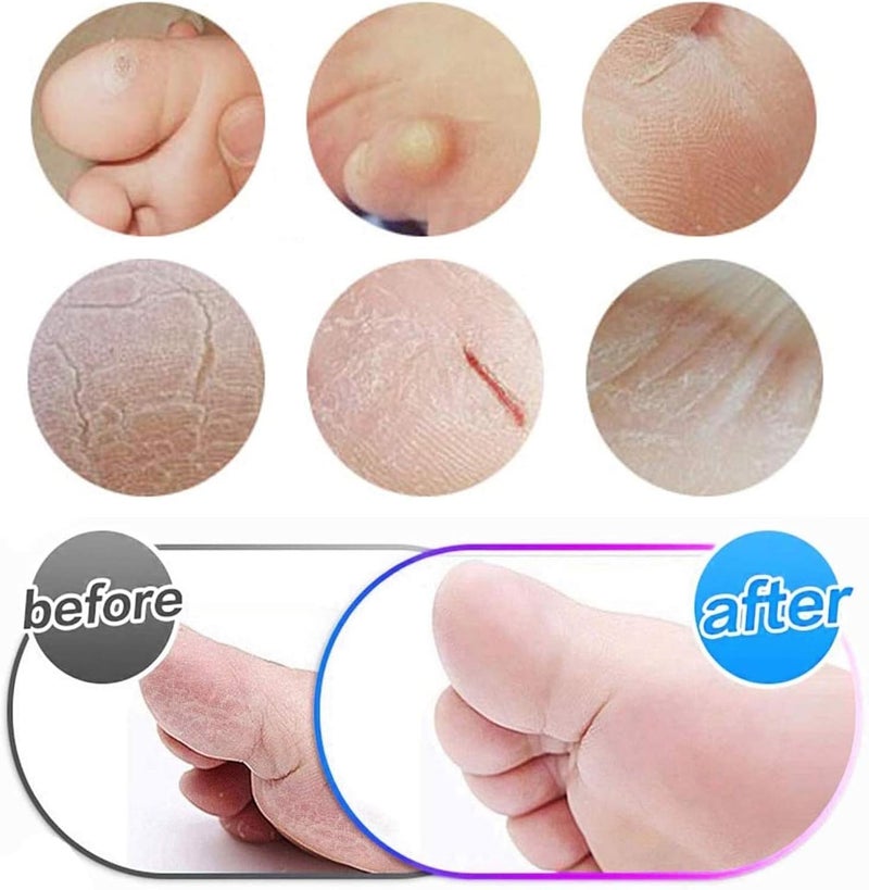 Bath Foot Scrubber Slipper with Built-in Stone, Silicone Shower Massage Sandal for Heel Care, Dead Skin Removal and Deep Foot Cleaning, One Piece Design (One pack (1 pieces)) - Image 3