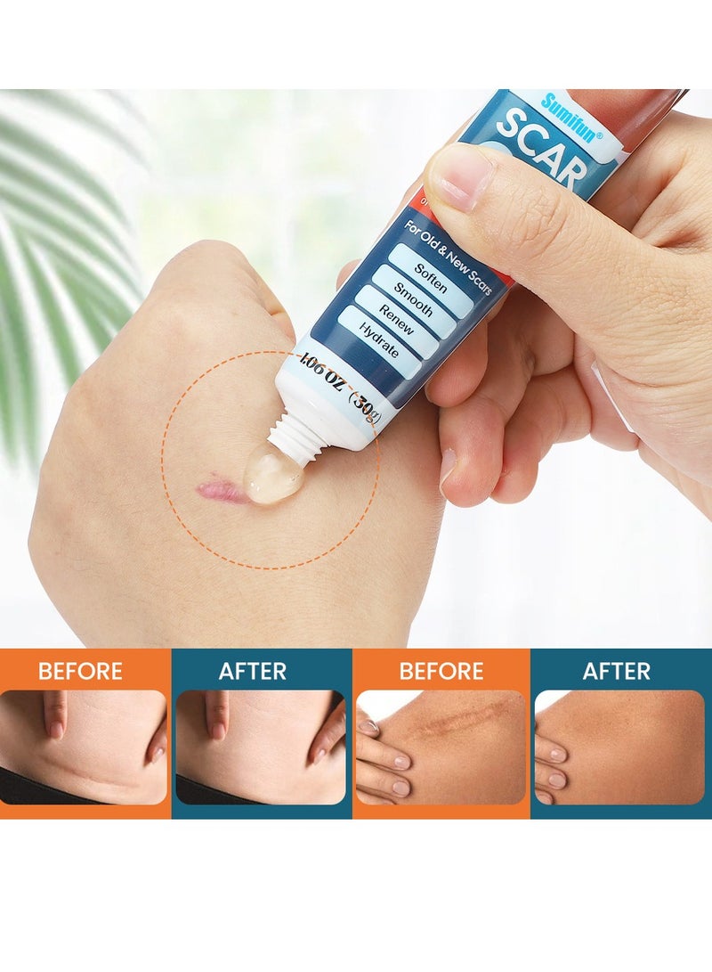Sumifun Scar Gel，Acne Scar Treatment，Deep Acne Scar Removal， Burns Keloids Hypertrophic， Scar Removal Cream， Repair Damaged Skin，Removing Acne Marks, Scar Repair Cream 30g - Image 5