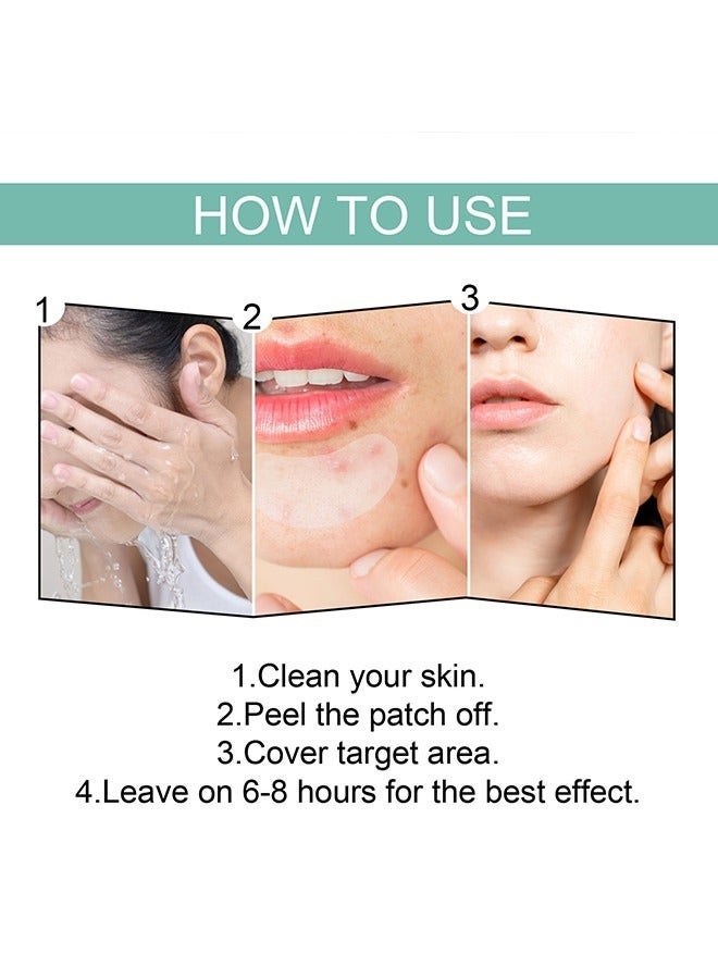 EELHOE Pimple Patches Acne Patches, 5 Sizes 132 Patches Pimple Patches For Face, Chin Or Body, Acne Treatment with Tea Tree And Salicylic Acid, Hydrocolloid Bandages For Acne Skin - Image 1