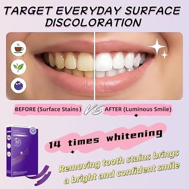 Teeth Whitening Strips – Purple, Enamel Safe, Removes Yellow Stains & Bad Breath, Non-Slip Dry Strip Technology (14 Count) - Image 5