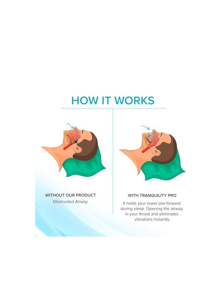 Generic Anti-Snoring Mouth Guard - Adjustable Mouthpiece - Night Time Teeth Mouthguard  Sleeping Bite Guard for Bruxism and Stop Snoring  - Image 4