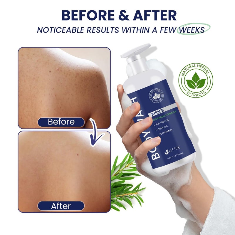 Uttse Tea Tree Body Wash: Antifungal Soap for Men - Eliminates Body Odors & Skin Irritations - 11.8fl oz/350mL - Image 5