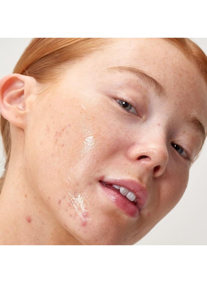 حمض خل التفاح بنسبة 2% من ذا انكي ليست يقشر توهج البشرة في 10 دقائق لتوحيد لون وملمسها 30 ملليلتر للجنسين لنوع جافة - Image 3