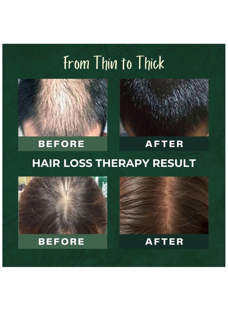 HEADS Botamix Hair Loss Therapy Shampoo for Anti Hair Loss Oily Scalp 1000ml HS5 - Image 4