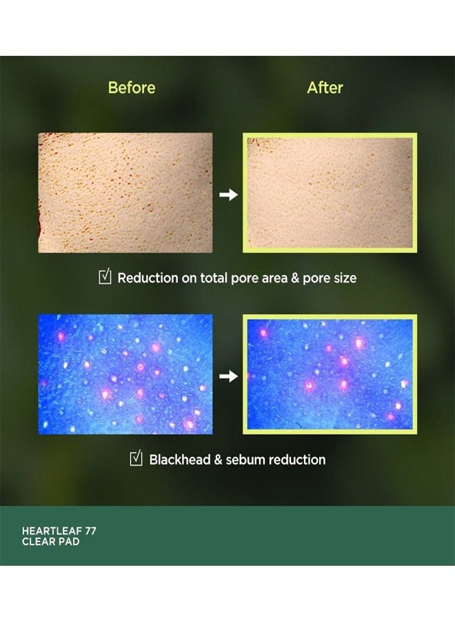 JS Heartleaf 77% Clear Pad 70 Sheets, PHA Dead Skin Care Low Ph Daily Toner Pad Exfoliating, Help Reduce Blackheads and Tighten Enlarged Pores, Balance Oily Skin By Reducing Excess Sebum  - Image 5