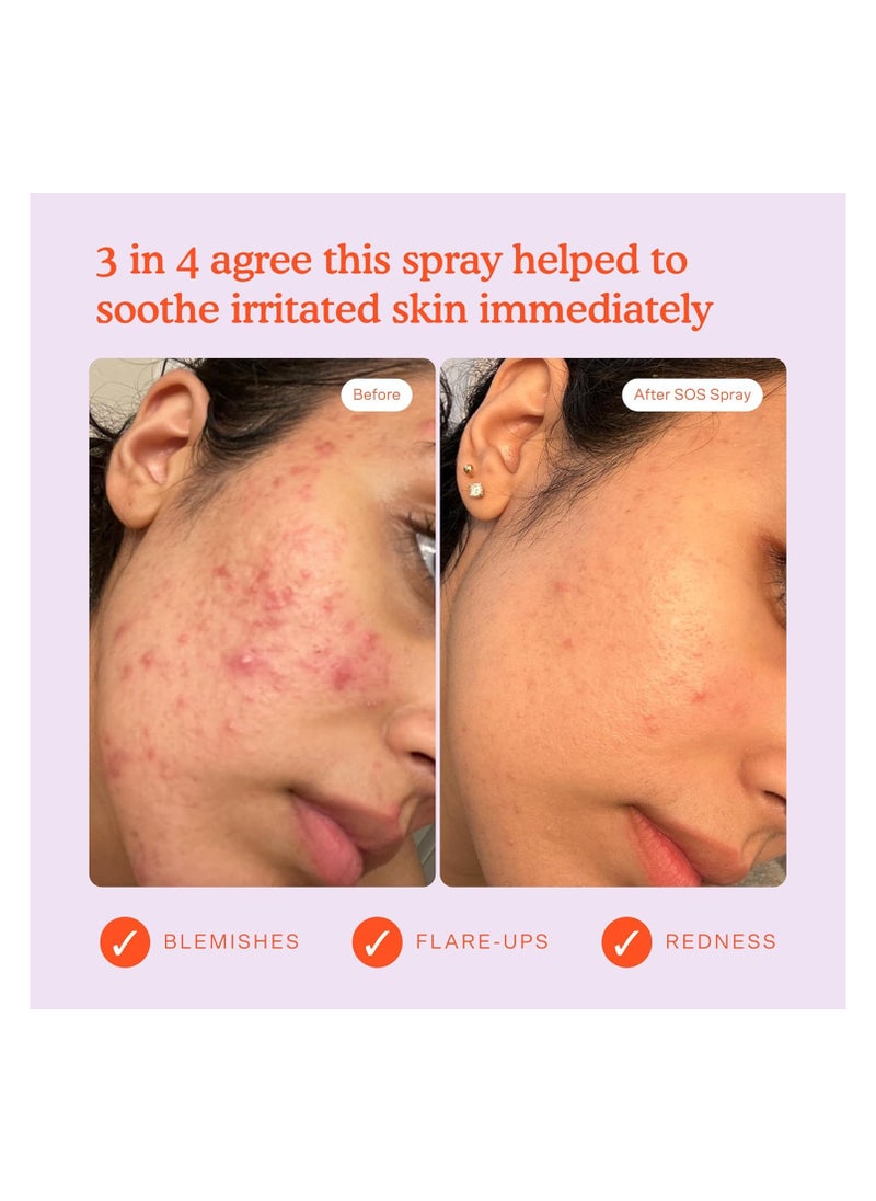 TOWER 28 SOS (Save Our Skin) Facial Spray  - Image 5