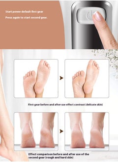 ETG Electric Callus Remover for Feet Rechargeable Pedicure Tools Foot Care Feet File 10 in 1 Callous Remover Kit for Remove Cracked Heels and Dead Skin with 3 Roller Heads 2 Speed Battery Display  - Image 3