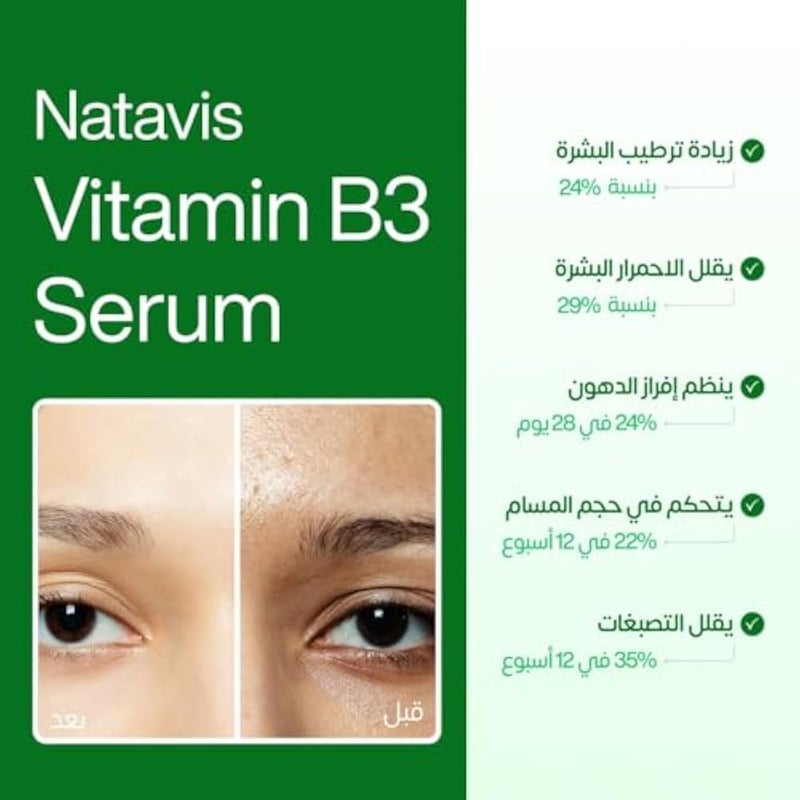 Natavis Vitamin B3 Serum – 30 ml – With Niacinamide (Vitamin B3) - Hyaluronic Acid - Vitamin E - Aloe Vera Extract – Glycerin - Acne Reduction - Skin Soothing - Pore Minimization - Deep Hydration - Image 4
