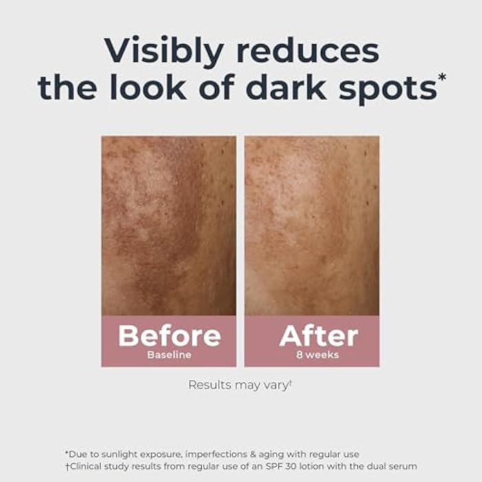 Eucerin Radiant Tone Dual Serum Dark Spot Corrector, Dark Spot Serum with Thiamidol and Hyaluronic Acid, Helps Visibly Reduce the Look of Dark Spots, Holiday Gifts for Self Care, 1 Fl Oz Bottle - Image 5