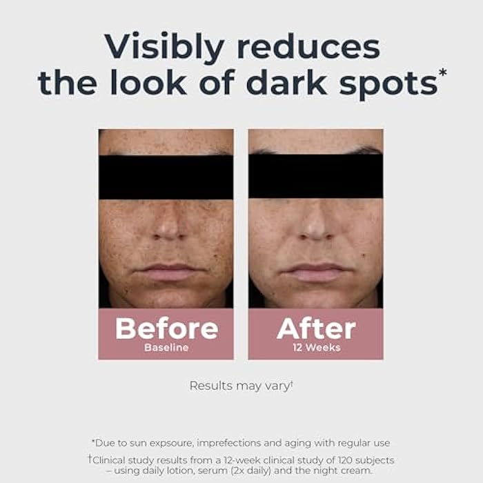 Eucerin Radiant Tone Dual Serum Dark Spot Corrector, Dark Spot Serum with Thiamidol and Hyaluronic Acid, Helps Visibly Reduce the Look of Dark Spots, Holiday Gifts for Self Care, 1 Fl Oz Bottle - Image 4