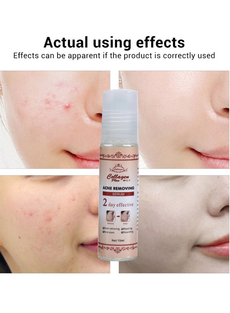 Collagen 2 Days Effective Acid Anti Acne Serum Collagen Acne Pimple Scar Repairing Acne Treatment Serum  - Image 4