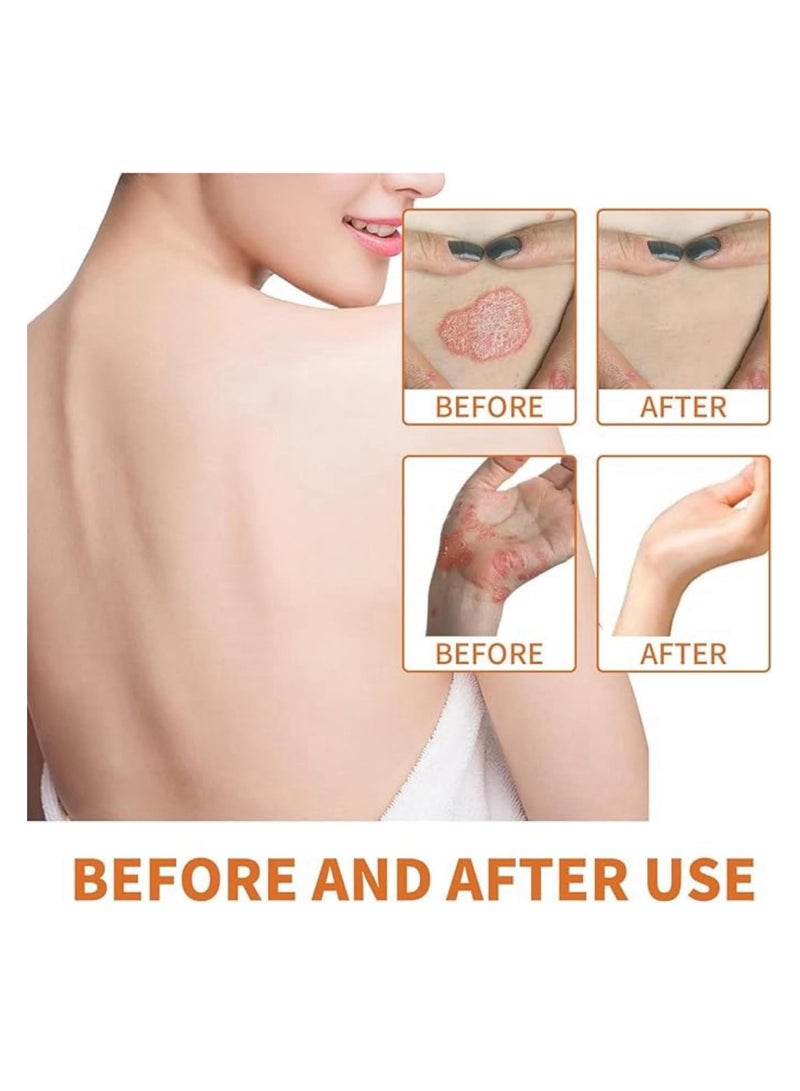 SYOSI Bee Venom Moisturizing Cream for Soothing Skin, Hydrating Body Cream for Comfort, Specialized Care for Sensitive Skin, Natural Skin Treatment, Suitable for All Skin Types (30g) - Image 2