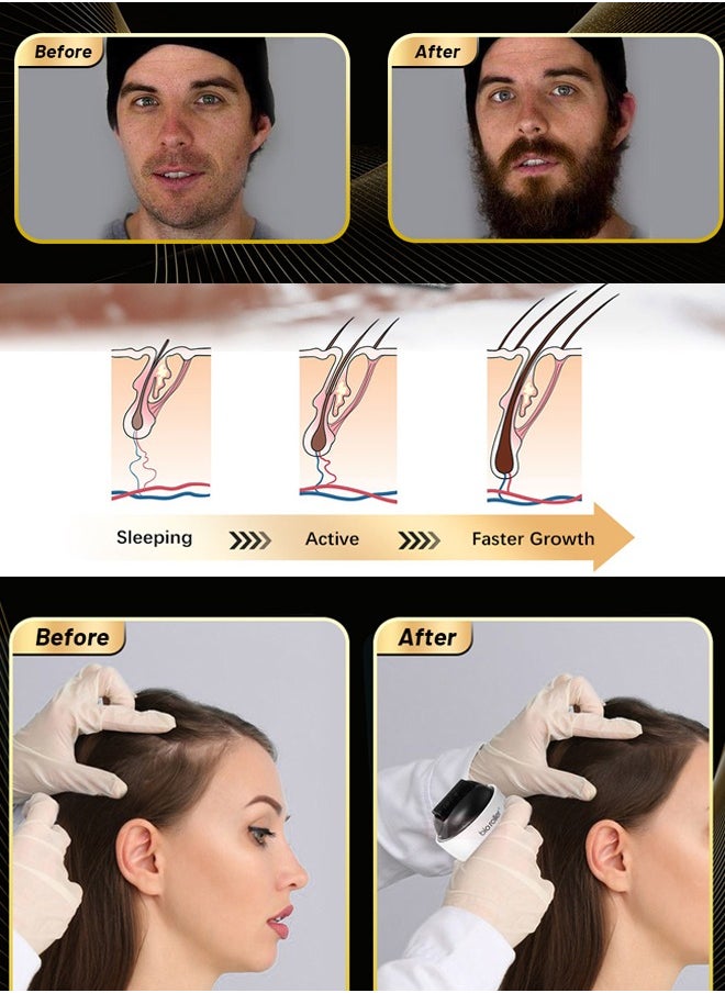 Bio Roller Microneedle Roller 0.5mm G4, Beard Roller for Men, Microneedling Roller for Hair Growth, Face Roller for Wrinkles and Lifting  - Image 3