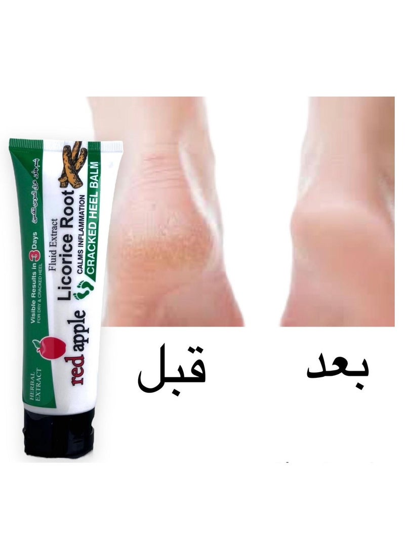 رد آبل بلسم جذور عرق السوس الطبيعي الكامل للقدمين ويتميز بسرعة رهيبة في شفاء قدميك من الأمراض اليومية مثل الجلد الجاف والمتشقق وتقشير الكعبين والبقع المسببة للحكة ويعمل على إزالة الروائح الكريهة 100 جرام  - Image 2