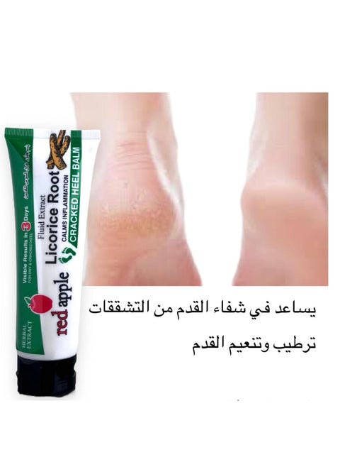 All Natural Licorice Root Foot Balm Super Fast Healing for Your Feet from Everyday Ailments Like Dry Cracked Skin Peeling Heels Itchy Spots and Removes Odor 100g