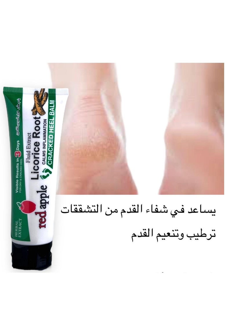 رد آبل بلسم جذور عرق السوس الطبيعي الكامل للقدمين ويتميز بسرعة رهيبة في شفاء قدميك من الأمراض اليومية مثل الجلد الجاف والمتشقق وتقشير الكعبين والبقع المسببة للحكة ويعمل على إزالة الروائح الكريهة 100 جرام  - Image 1