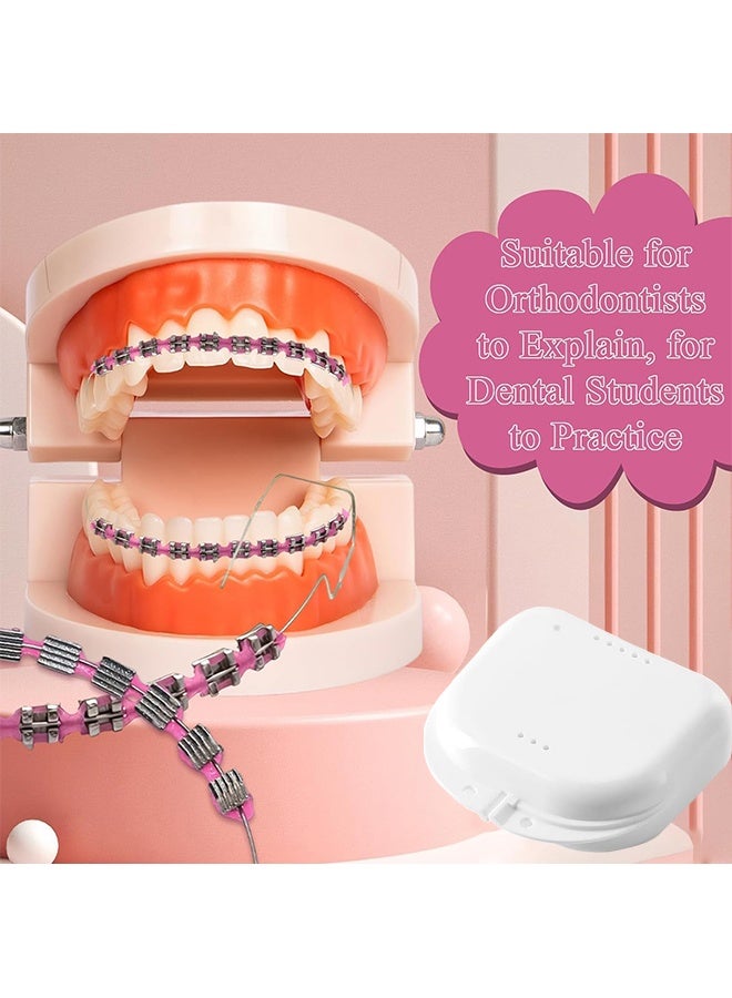 Depend Metal Braces For Orthodontics, Metal Bracket And Orthodontic Ligature Ties, Props For Dental Students Orthodontic Practice To Practice - Pink With A White Box - Image 5
