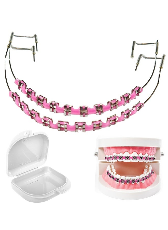 Depend Metal Braces For Orthodontics, Metal Bracket And Orthodontic Ligature Ties, Props For Dental Students Orthodontic Practice To Practice - Pink With A White Box - Image 1