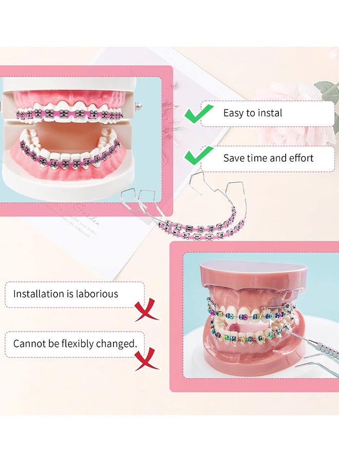Depend Metal Braces For Orthodontics, Metal Bracket And Orthodontic Ligature Ties, Props For Dental Students Orthodontic Practice To Practice - Pink With A White Box - Image 4